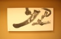 クリックして拡大 endo01